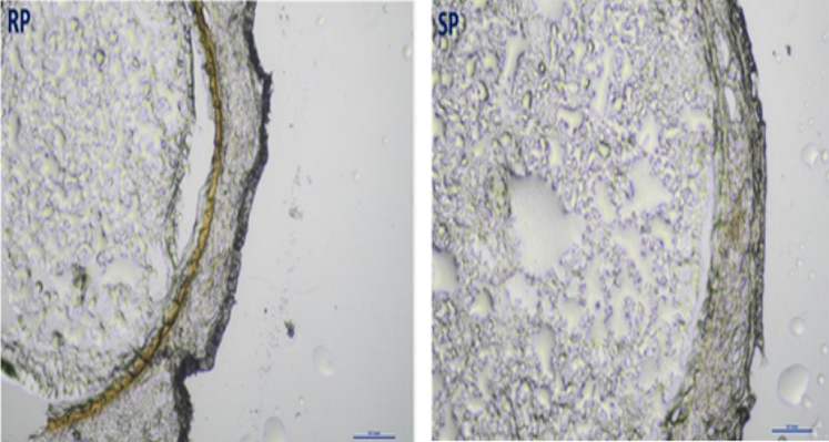 Microscope images of secondary cell wall in groundnut varieties.